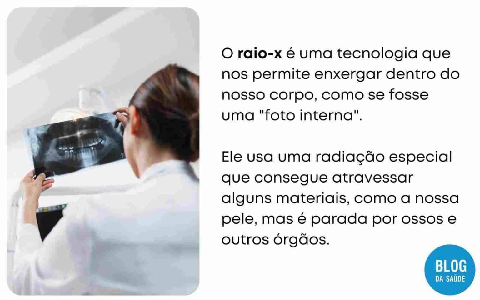 Qual A Import Ncia Do Raio X Para Que Serve Blog Da Sa De