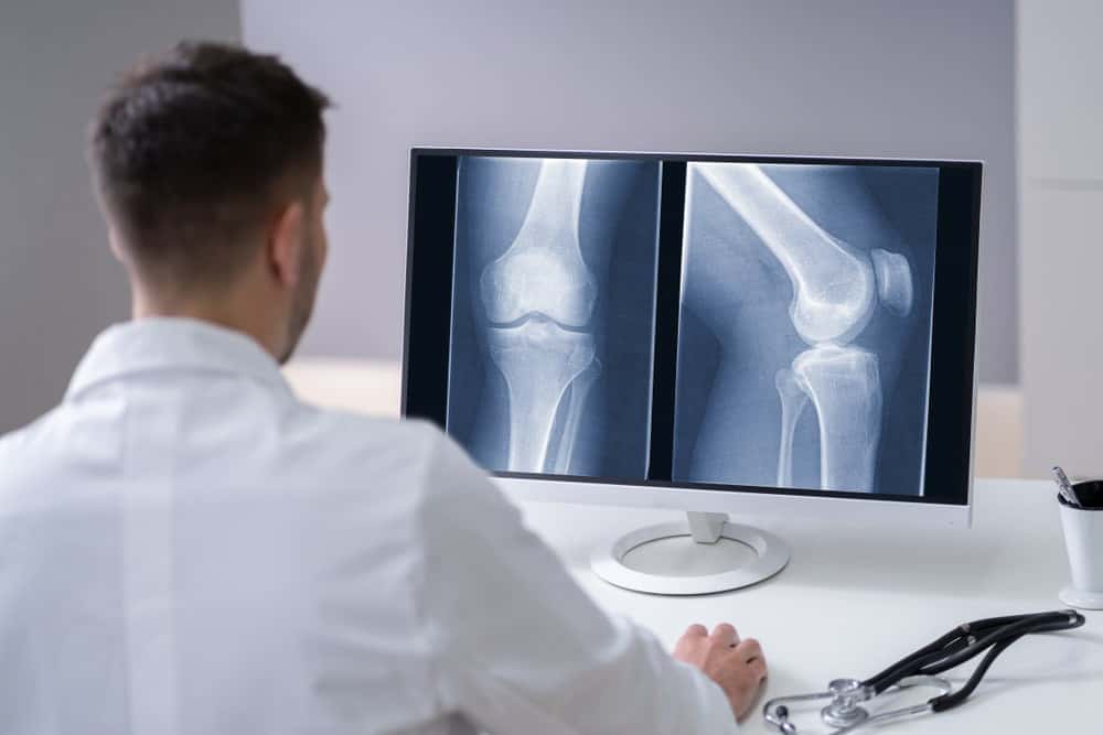 radiografia do joelho