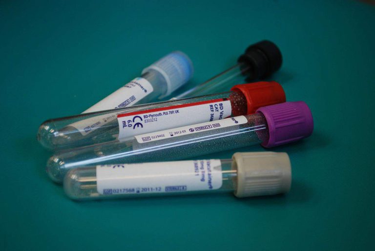 VHS elevado: o que significa no exame de sangue
