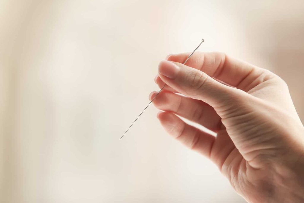 Acupuntura