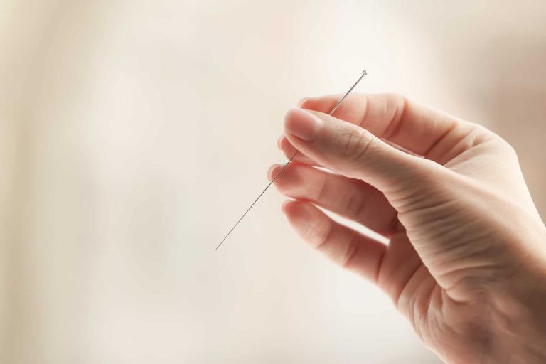 Acupuntura