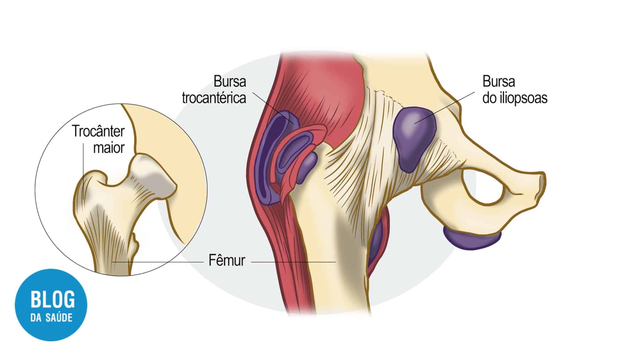 Bursite: O Que é? Sintomas, Causas E Tratamentos - Blog Da Saúde