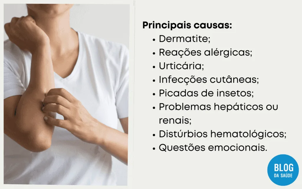 Coceira pelo corpo 2 1