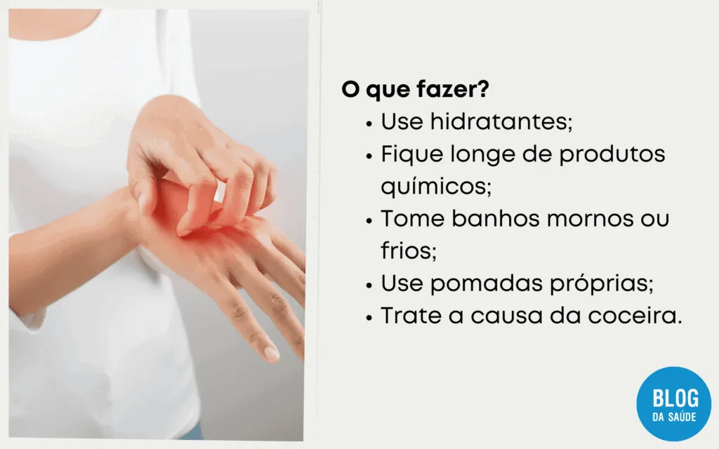Coceira pelo corpo 3 1 1