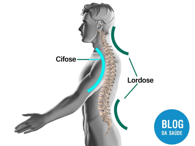 Curvas da Coluna Vertebral
