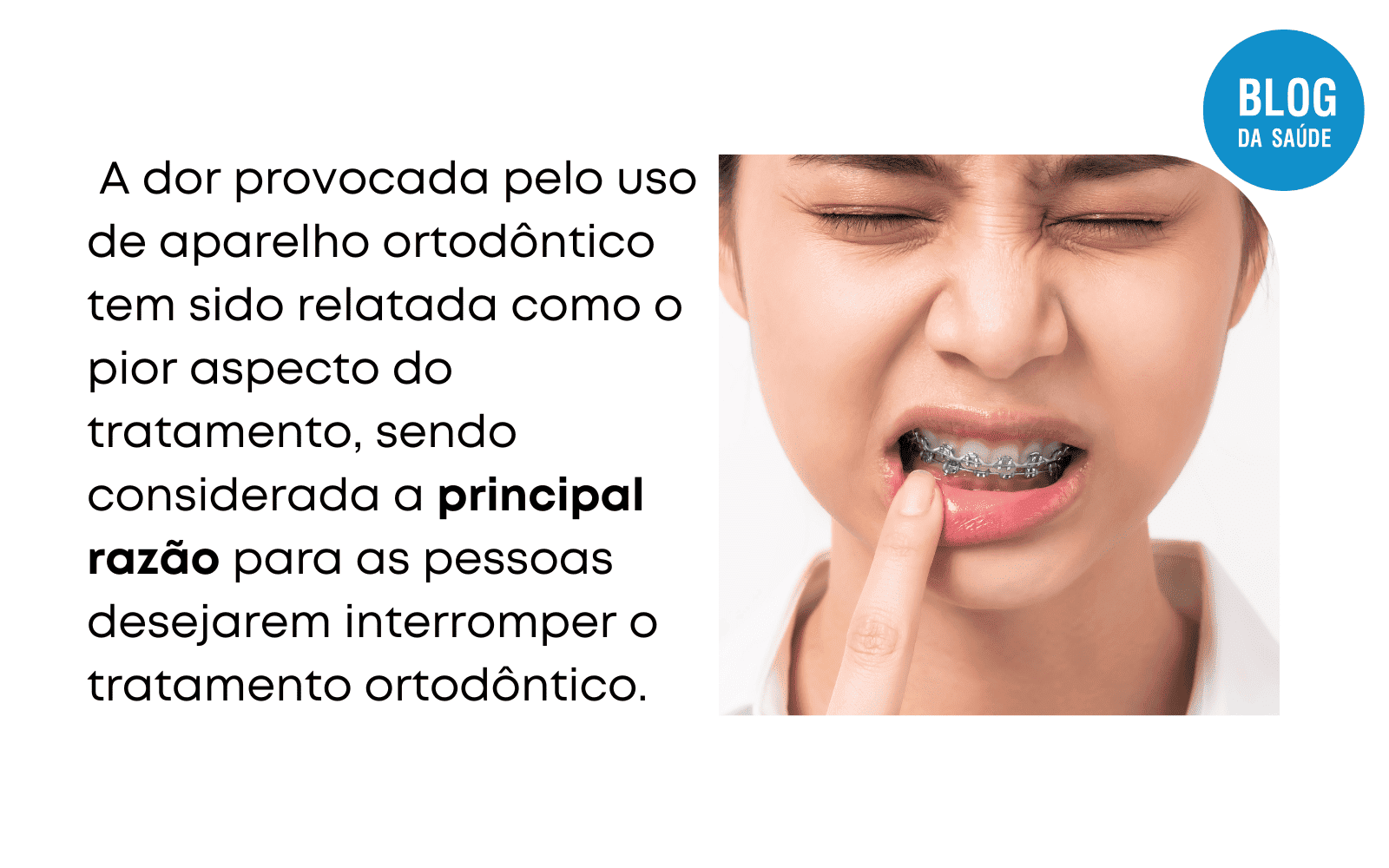 Dipirona Alivia Dor De Aparelho? - Blog Da Saúde