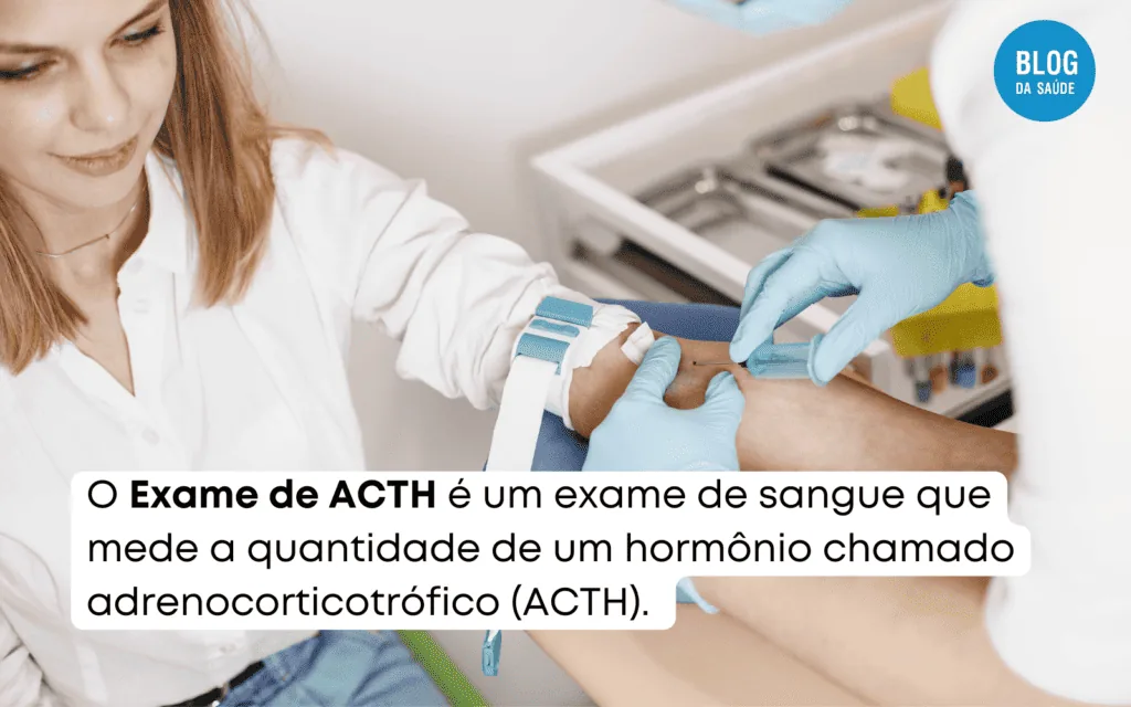 Exame de ACTH no sangue: para que serve 1 Exame de ACTH