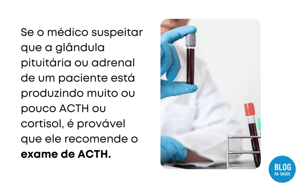 Exame de ACTH no sangue: para que serve 2 Exame de ACTH 1