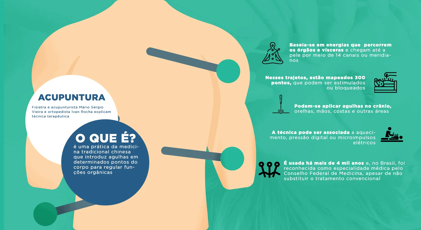 Infografico Acupuntura