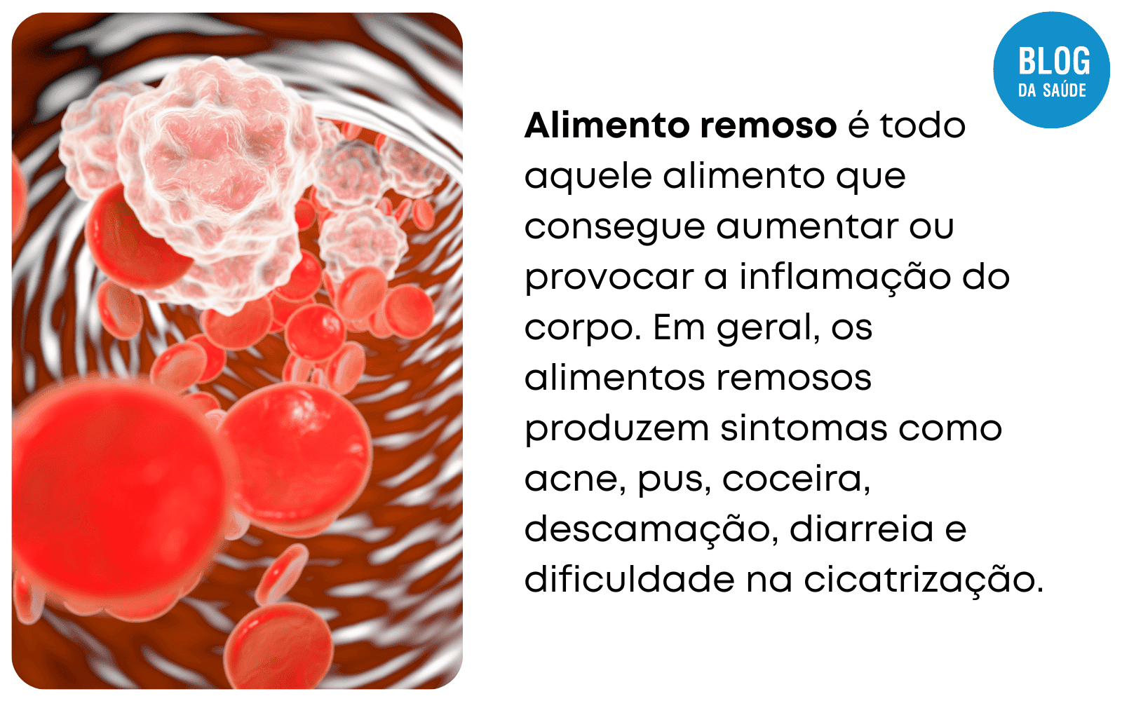 Manga é Remoso? Descubra Os Benefícios E Possíveis Malefícios Da Fruta ...