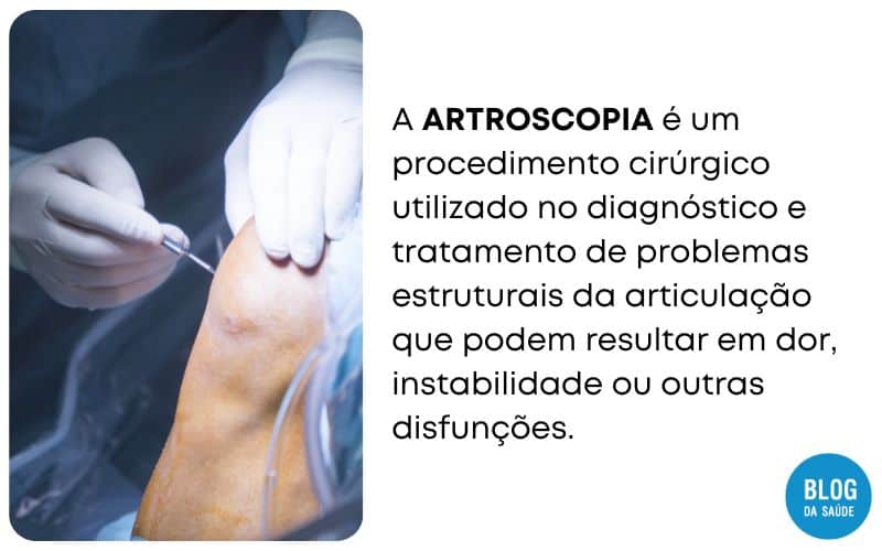 O que é Artroscopia? A Revolução da Cirurgia Minimamente Invasiva 2 O QUE E ARTROSCOPIA 1