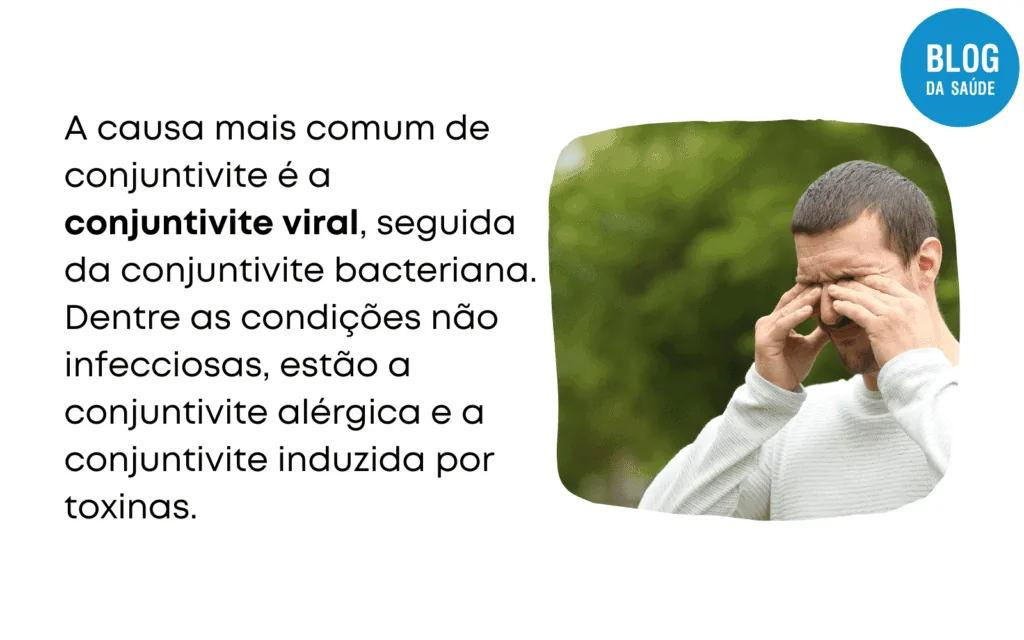 POMADA PARA CONJUNTIVITE 2 1