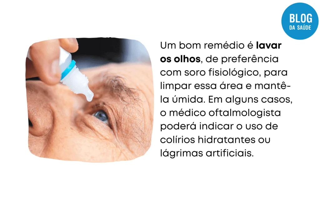 POMADA PARA CONJUNTIVITE 3 1