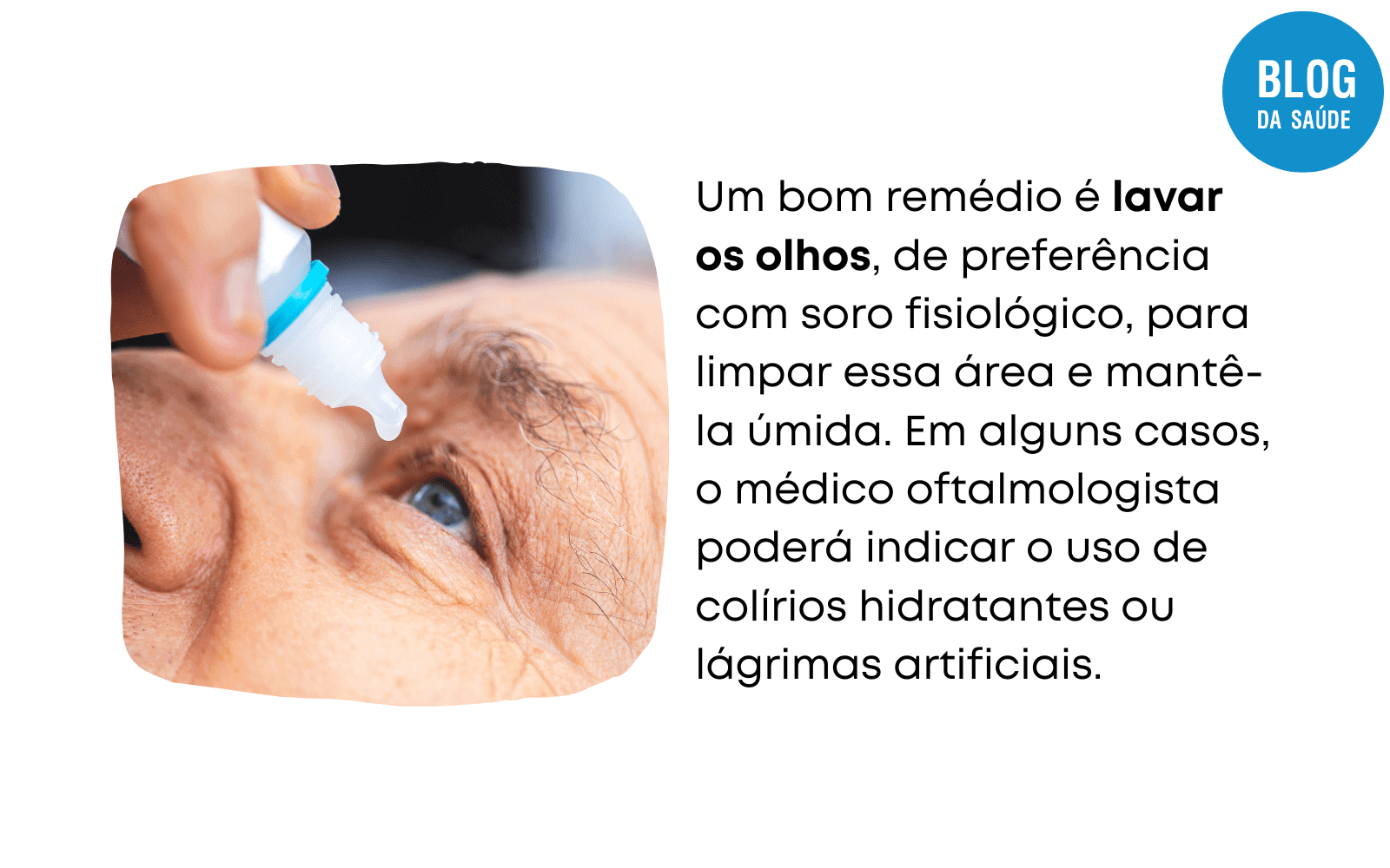 Pomada Para Conjuntivite - Blog Da Saúde