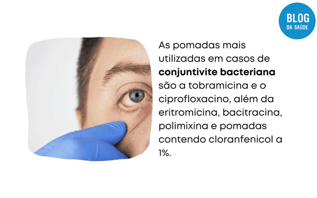 POMADA PARA CONJUNTIVITE 4 1