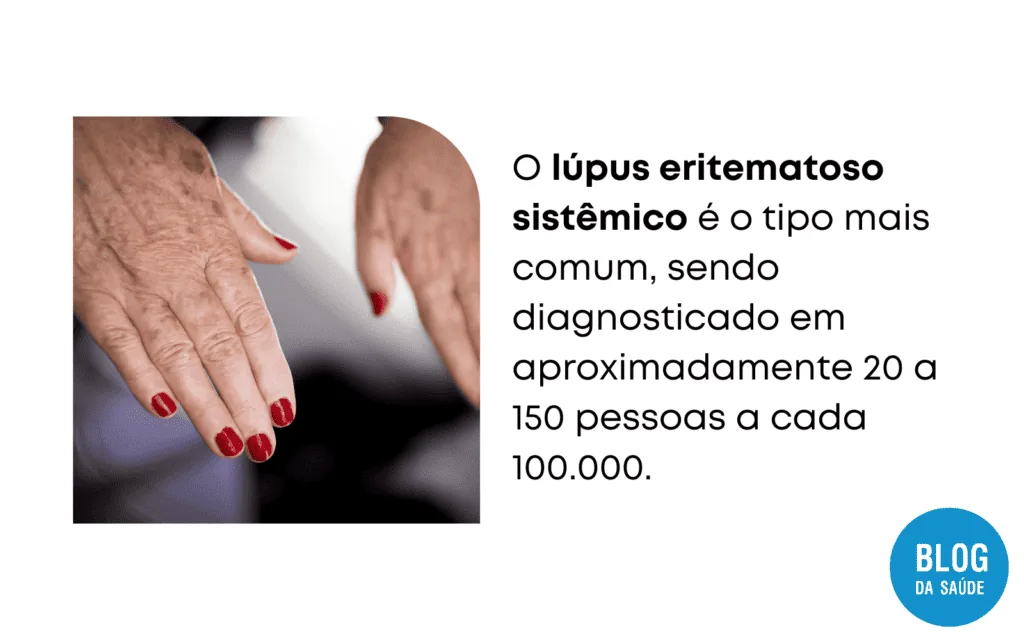 Quem tem lupus pode engravidar 2 1