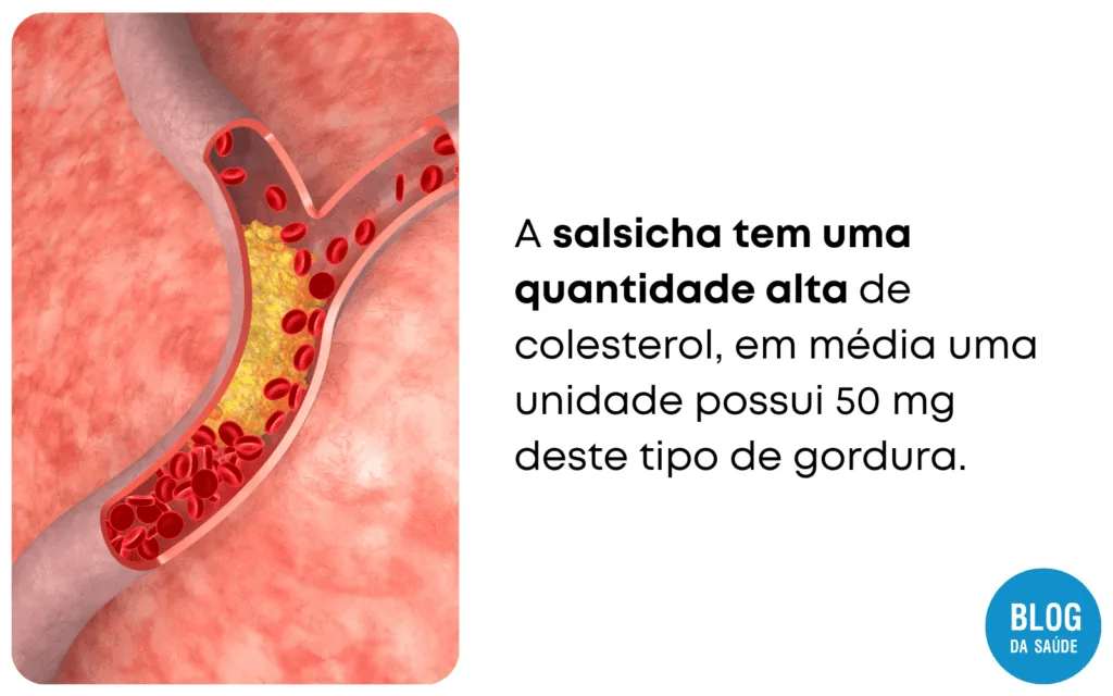 Salsicha e remoso 4 1