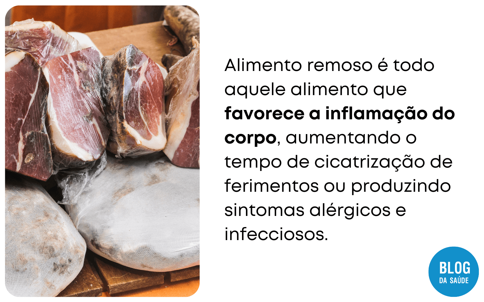 Carne Seca é Remosa? - Blog Da Saúde