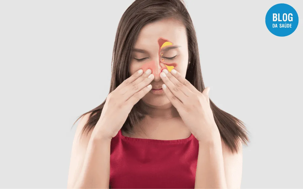 Rinite Medicamentosa - Causa comum de Obstrução Nasal 1 Rinite Medicamentosa