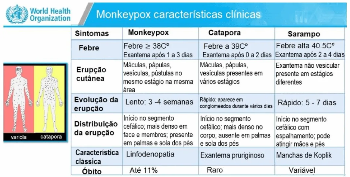 Sintomas Variola dos Macacos