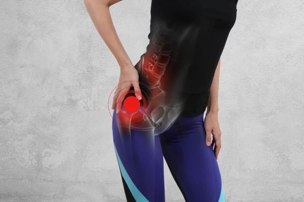 Tendinopatia do glúteo - Inflamação do Glúteo Médio e Mínimo 1 Tendinopatia do gluteo medio e gluteo minimo