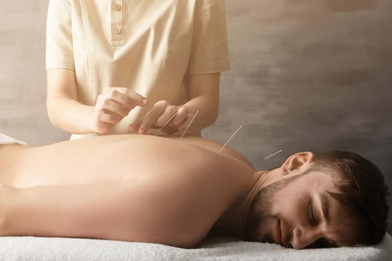 Acupuntura: Um Tratamento Para A Dor Oncológica