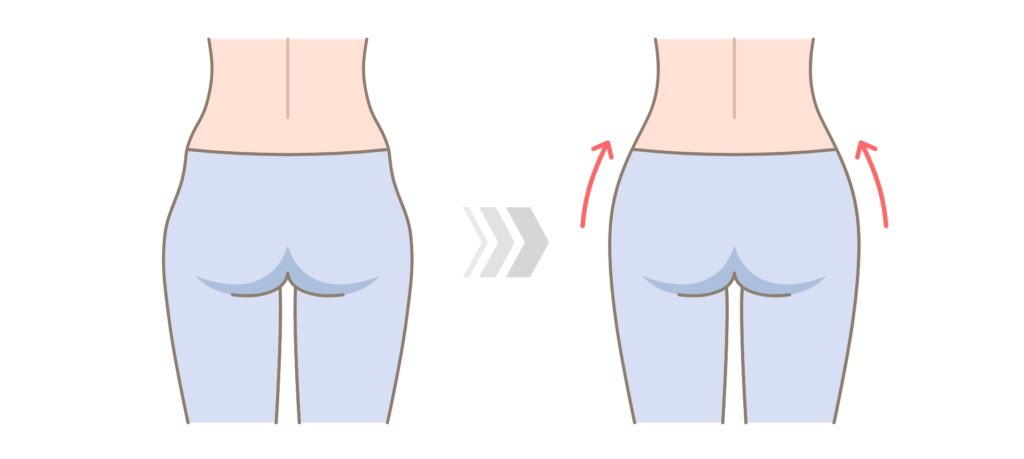 Desmistificando os 'Hip Dips': A Verdade Sobre Anatomia, Exercícios e Soluções Estéticas 2 anatomia hip dips
