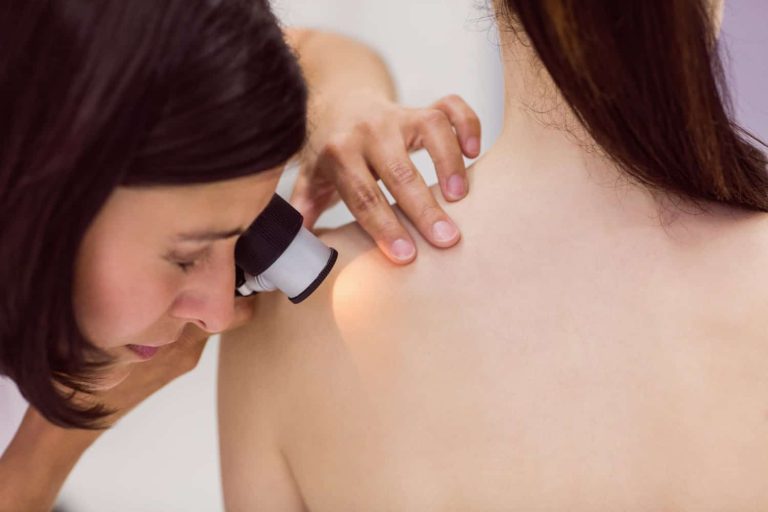 avaliacao pele dermatoscopia dermatologista