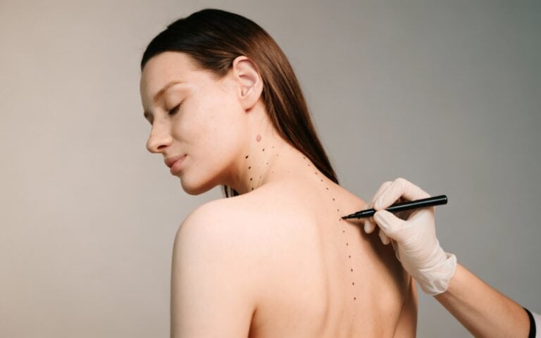 BOTOX (Toxina Botulínica) para Dor no Elevador da Escápula 7 botox elevador da escapula sp