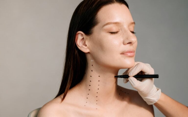 BOTOX para tensão e dor no Trapézio! Toxina Botulínica como adjuvante 7 botox trapezio sao paulo