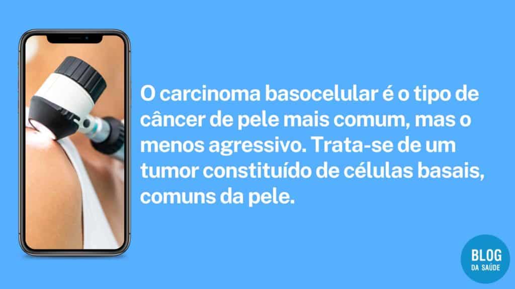 carcinoma basocelular 1