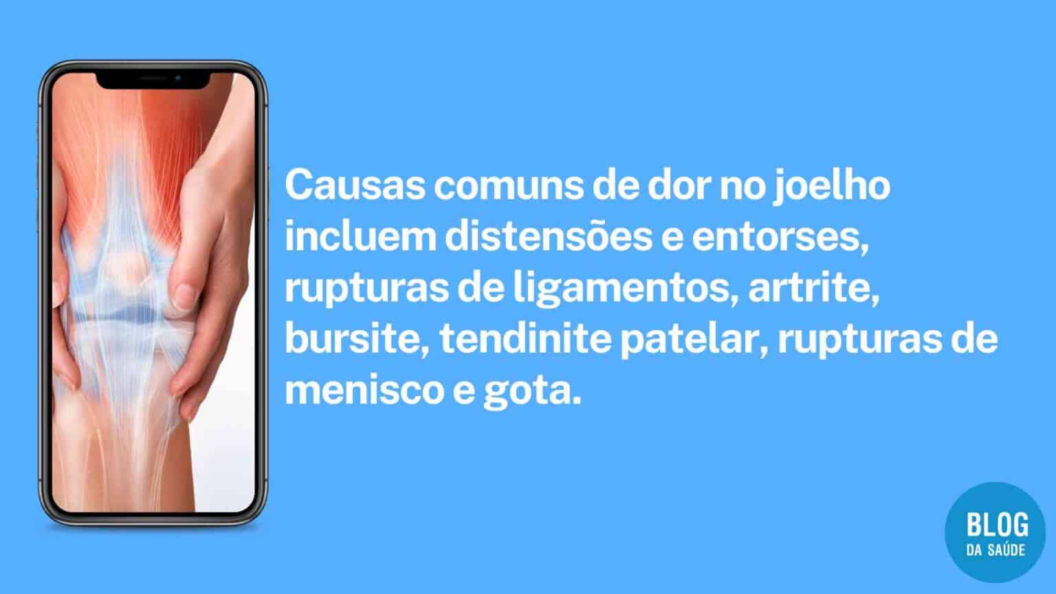 Dor No Joelho - O Que Pode Ser? Causas Comuns, Sintomas E Tratamentos ...