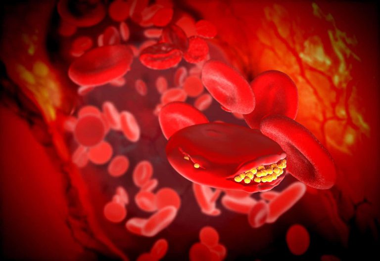 Colesterol LDL, HDL, VLDL e total: entenda
