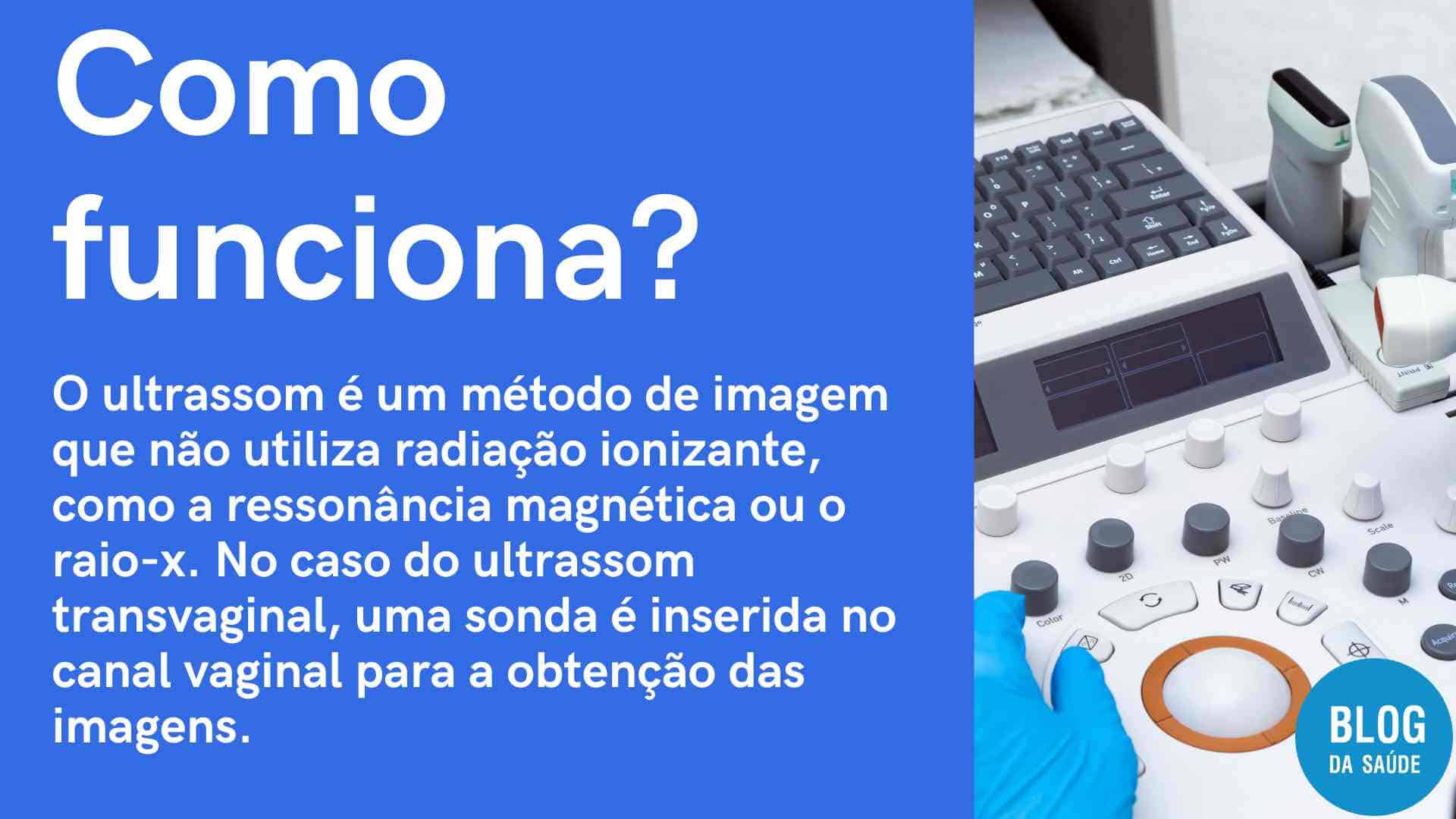 Ultrassom Endovaginal (Transvaginal): Para Que Serve? - Blog Da Saúde
