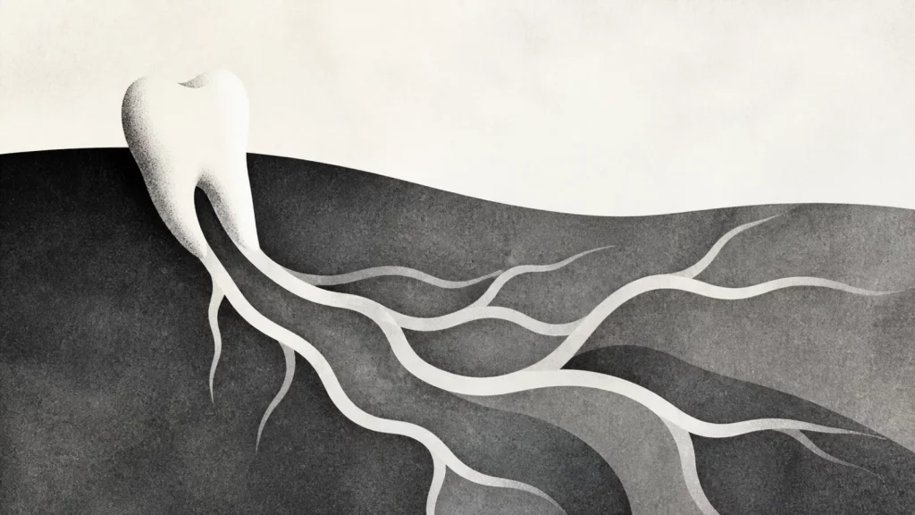 Ilustração editorial abstrata em tons de cinza sobre dente do siso tem raiz