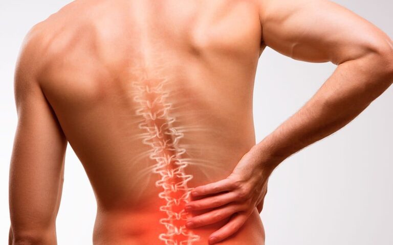 edema dos ligamentos interespinhosos capa