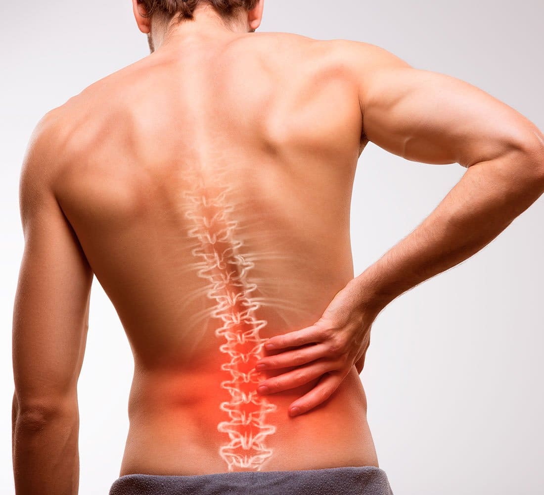 edema dos ligamentos interespinhosos capa