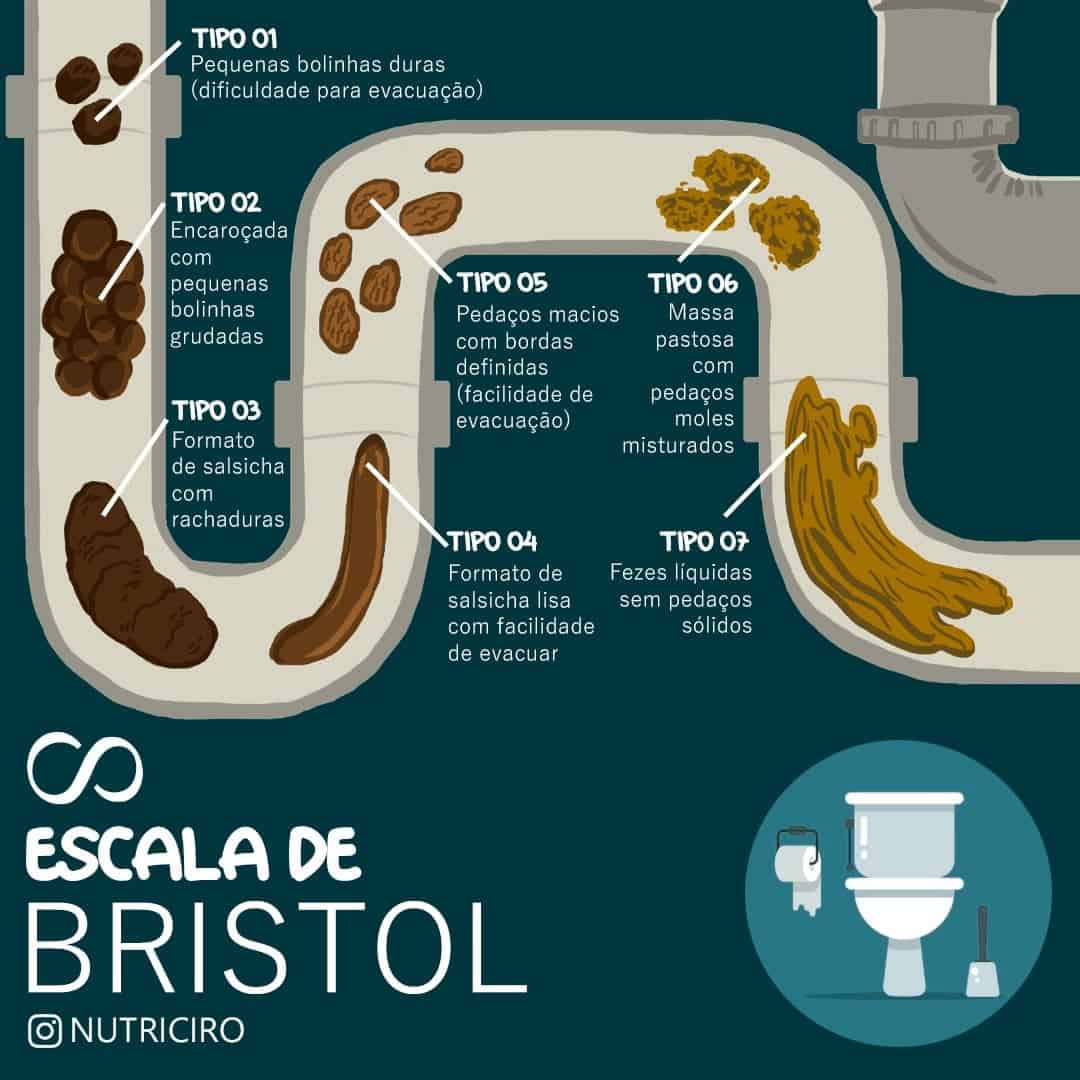 Voc Sabe O Que A Escala De Bristol Blog Da Sa de