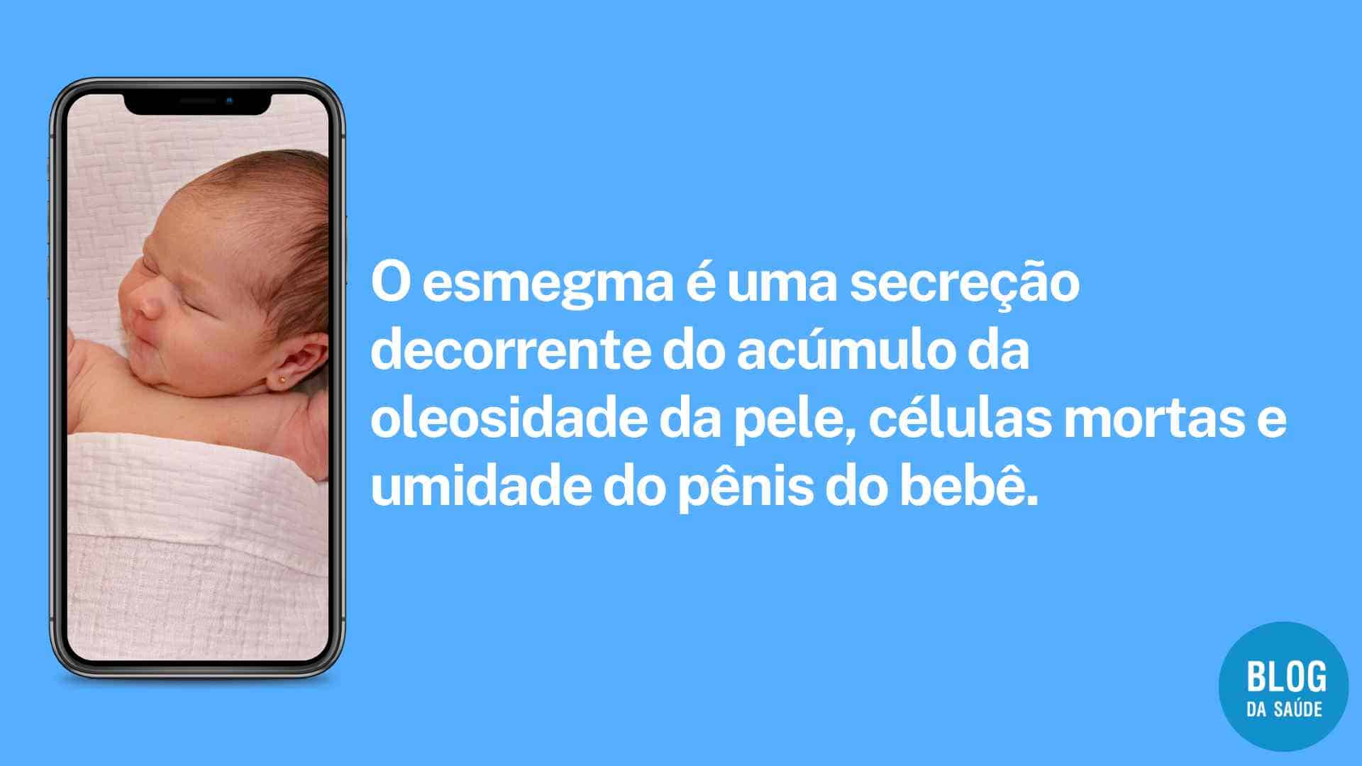 Esmegma O Que é E Como Tratar E Prevenir Blog Da Saúde