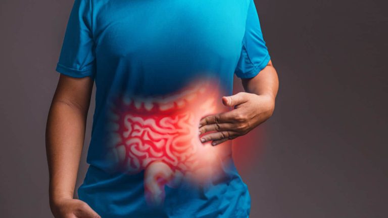Disbiose – O Que É? Sintomas, Causas e Tratamentos com Alimentação e Suplementos