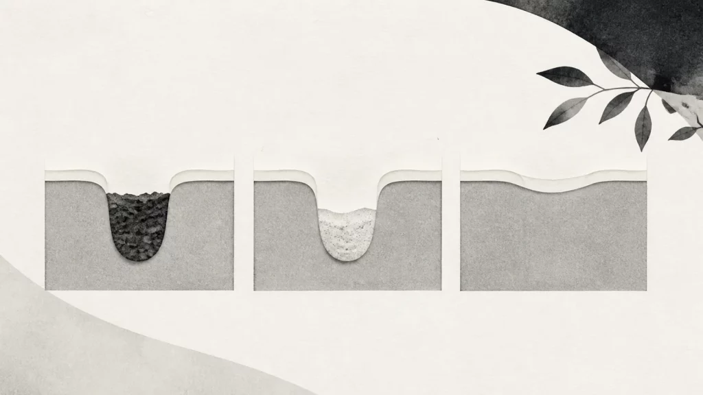 Ilustração editorial abstrata em tons de cinza sobre como fica a gengiva após extração do siso