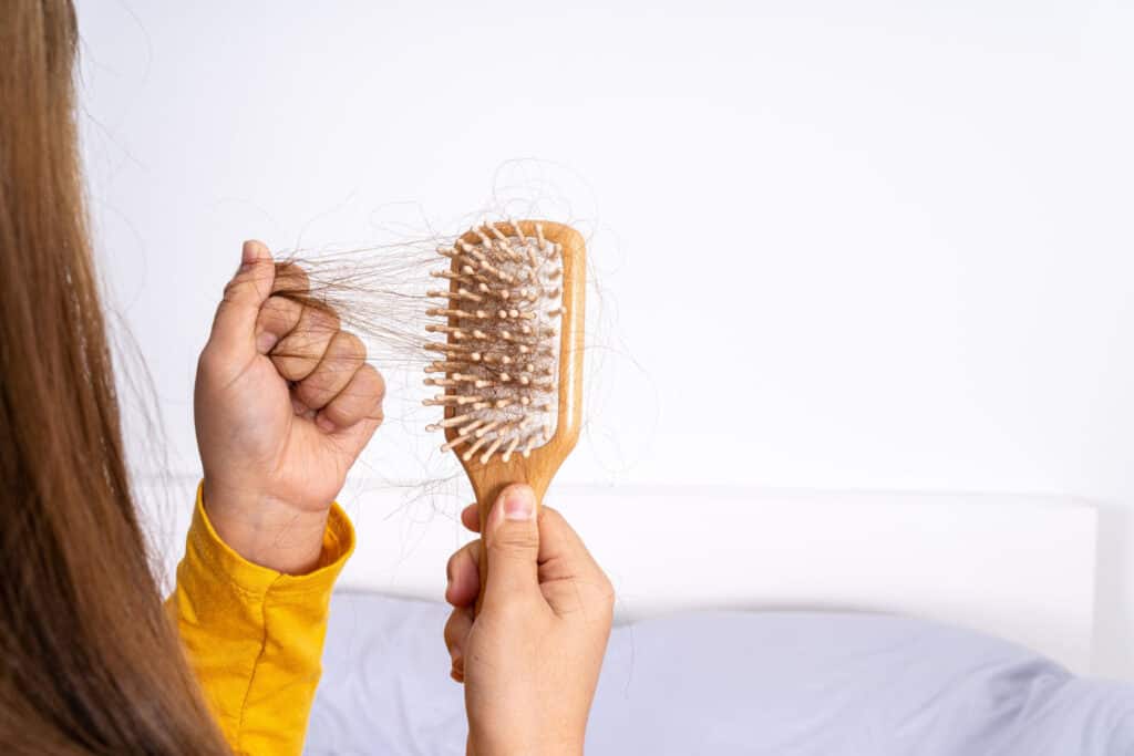 Queda de cabelo pós-covid: causas e tratamento 1 Queda de cabelo pós-covid: causas e tratamento