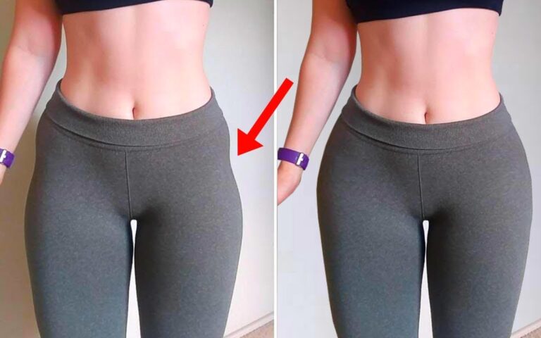 Desmistificando os 'Hip Dips': A Verdade Sobre Anatomia, Exercícios e Soluções Estéticas 1 hip dips o que e
