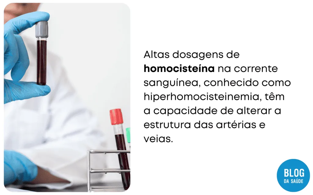 homocisteina acido folico vitamina B6 e vitamina B12 2 1