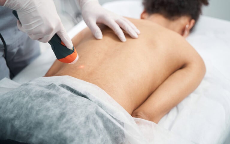 Como Funciona a Terapia com Laser de Alta Intensidade 4 laser alta intensidade regerativo