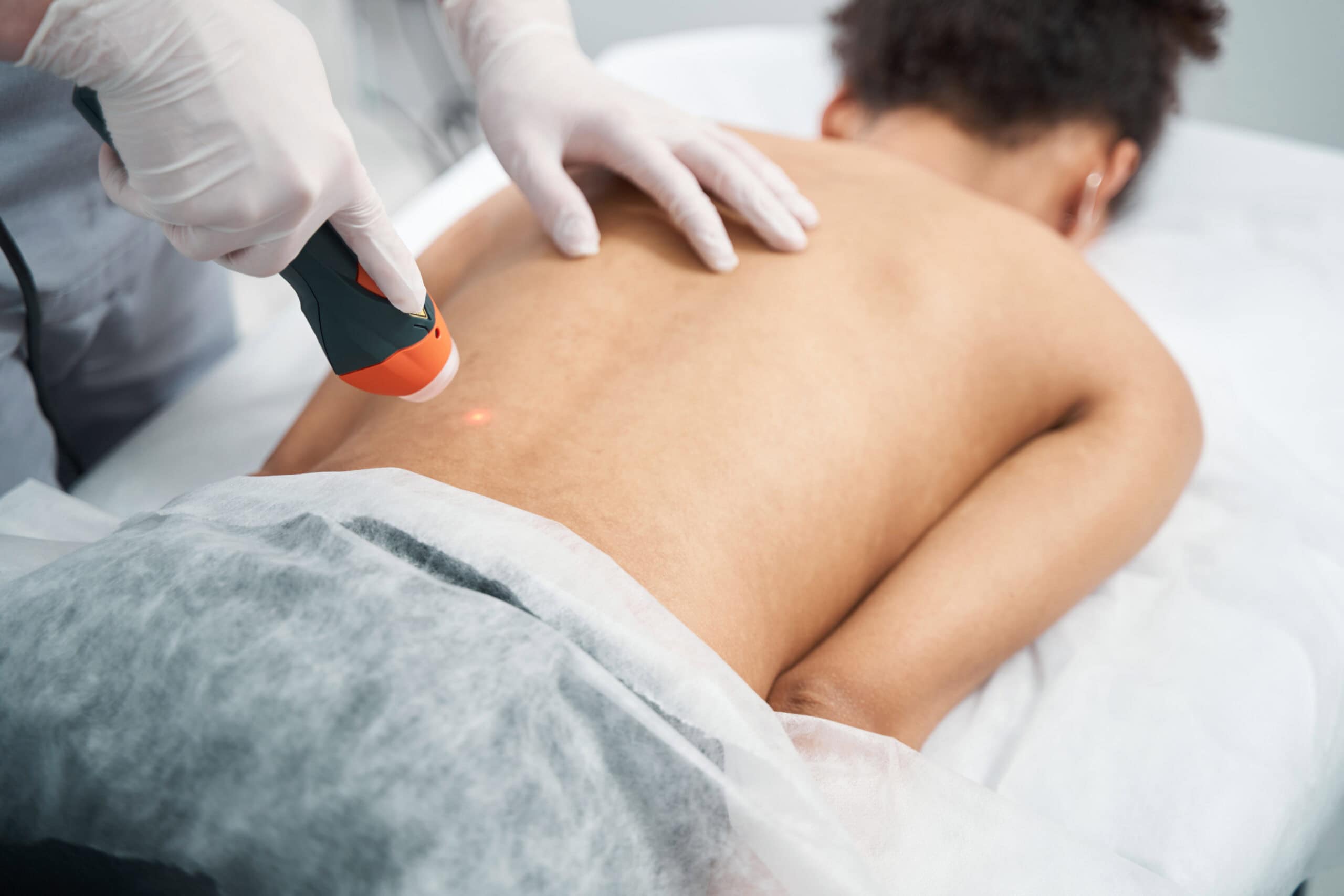 laser alta intensidade regerativo