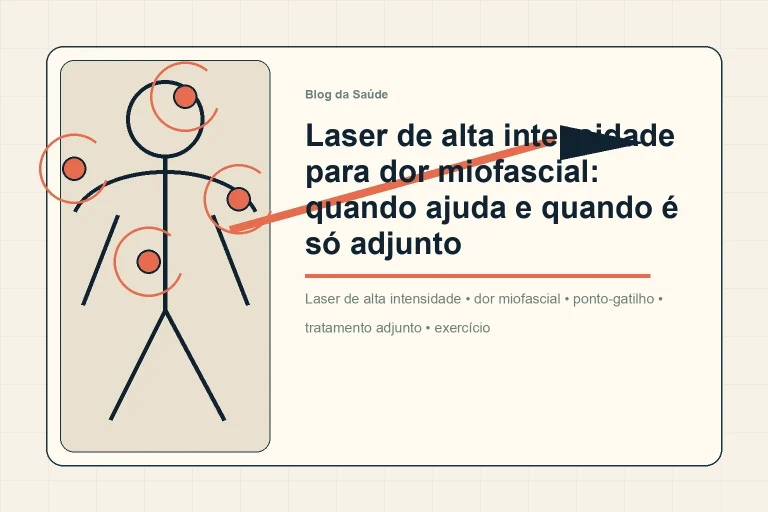 Ilustração editorial mostra laser de alta intensidade como adjunto para dor muscular regional.
