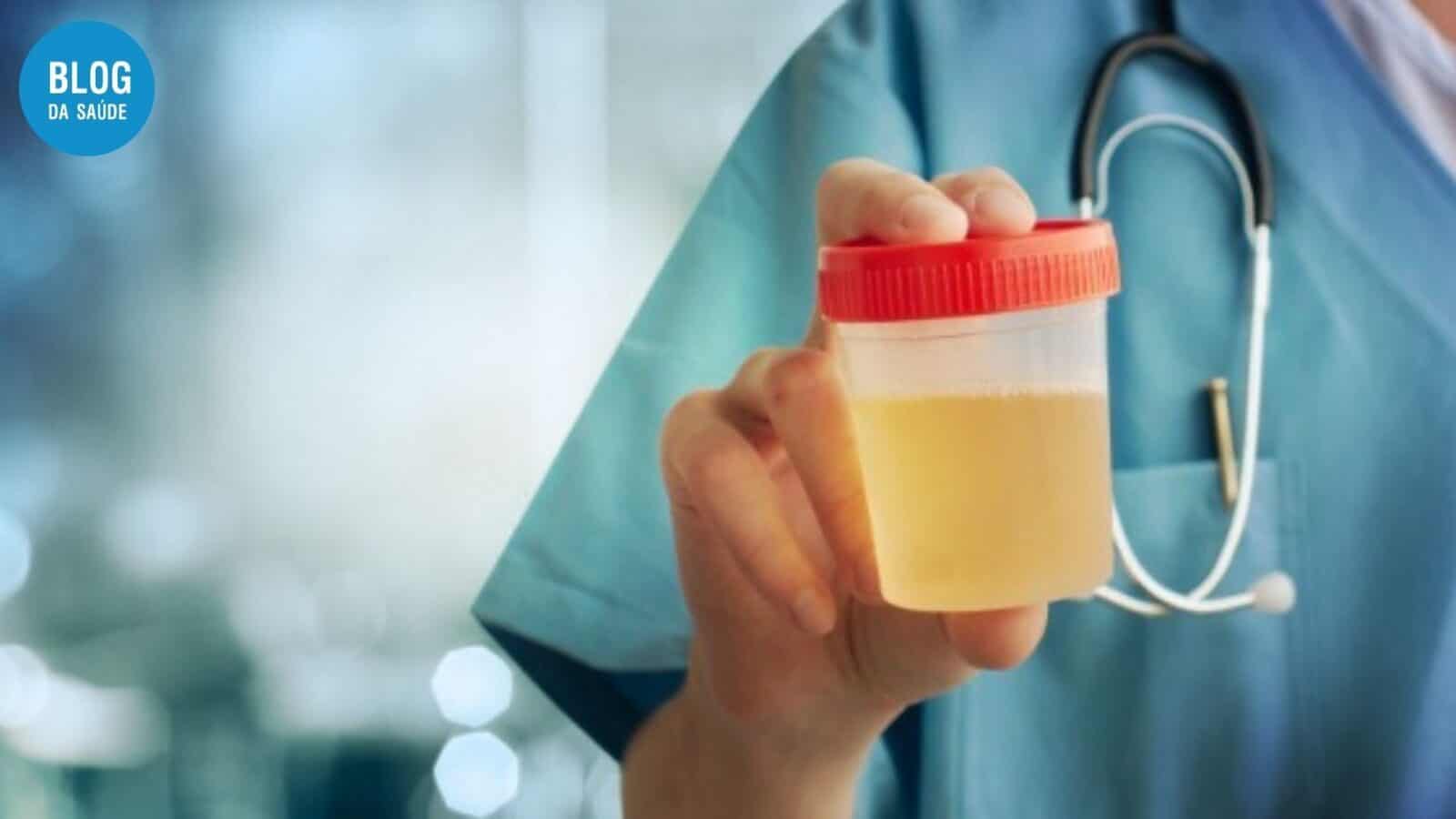 Leucócitos na Urina: Porque acontece e o que fazer 14 leucócitos na urina