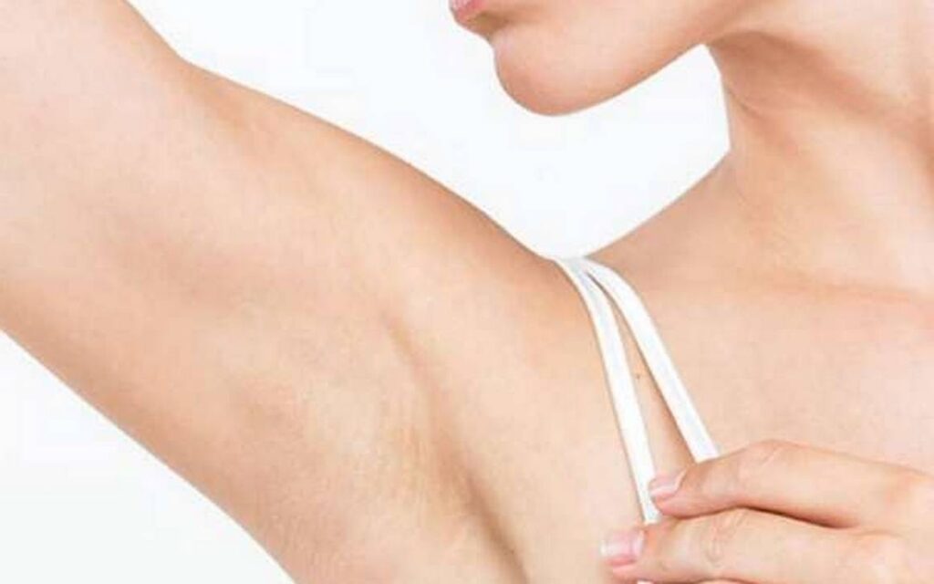 Axilas Escuras (Manchas nas Axilas): Guia Completo Sobre Causas, Prevenção e Tratamentos Dermatológicos 2 manchas axilas