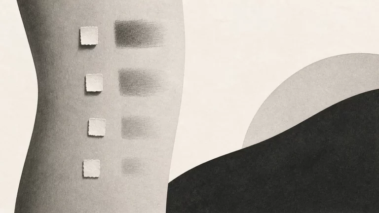 Ilustração editorial abstrata em tons de cinza sobre como tirar manchas nas pernas causadas por feridas